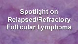 Spotlight on Relapsed/Refractory Follicular Lymphoma